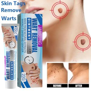 7 Days Skin Tag Remover Warts Remover For Body Acne Treatment Warts Remover Facial Skin Tag Removal Remove Warts without Leaving Scars 20g