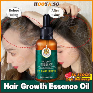 ✅SG stock✅ Ginger hair growth serum / Fast hair growth essence / Anti hair loss serum / Ginger hair tonic / Hair loss treatment