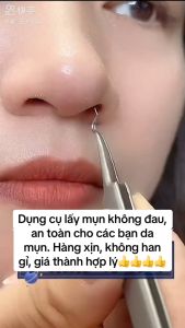 Nhíp gắp mụn thần thánh chất liệu thép không gỉ