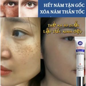 Kem Dưỡng Làm Trắng Da Đánh Bay Nám Tàn Nhang Yilumei Dưỡng Trắng Che Khuyết Điểm Nhẹ Nhàng Nhanh Chóng