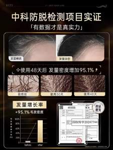 RUYI | Hair Loss Prevention Growth Serum