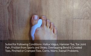 [1pair] FeetCare Bunion Silicone Toe Spreader | Toe Separator for Big Toe | Anti-Rubbing | Bunion Pain Relief