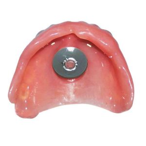 🔥品质 精选🔥Dental Suction Cup Full Mouth Movable Denture Skin Pad Consumables Anti-Falling Italian Rubber Tray cxbyqlh96