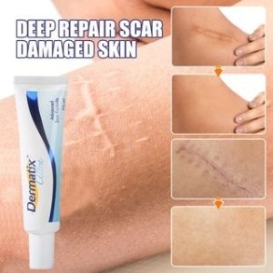 Dermatix Ultra Gel: A Comprehensive Guide to Scar & Acne Treatment