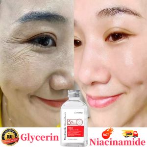 Ready Stock Original Nicotinamide Glycerin Aloe Anti Aging Wrinkle Moisturizer Brightening Hydrating Whitening gliserin140ML马来西亚甘油烟酰胺缓解干燥精华液补水精华