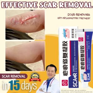 Scar Remover For Old And New Scar Scarminator Cream Skin Repair Cream Repair Acne Scar Spot Remove Stretch Marks Whitening Dark Spot Acne Treatment Cream Relieving Itching Cream 20g 祛疤膏