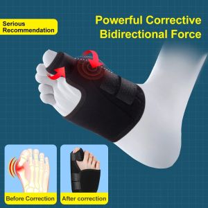 YUOO 1Pair Bunion Splint Big Toe Straightener Corrector Foot Pain Relief Hallux Valgus Correction Orthopedic Supplies
