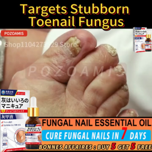 รักษาเชื้อราเล็บ ยาทาเชื้อราเล็บ เชื้อราที่เล็บ รักษาเล็บ เชื้อราที่เล็บ รักษาเล็บขบ ฆ่าเชื้อราที่เล็บ 30ml