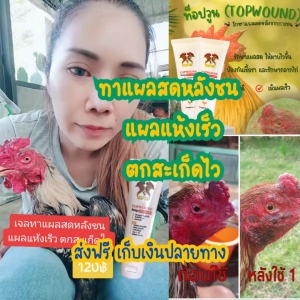 เจลทาแผลสดหลังปล้ำ หลังชน ท็อปวูน