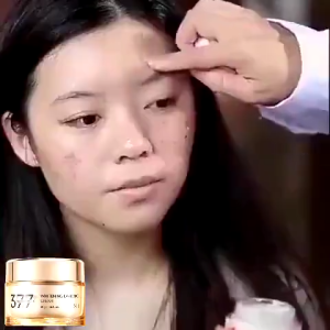 377 Dark Spot Whitening Cream 30g krim pencerah esensi pencerah cocok untuk melasma dan bintik-bintik penuaan. Krim wajah yang mencerahkan dan melembapkan.