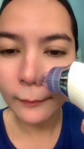 Areti XN8030 Pore Suction Device.Complete Set with charger multifunctional blackhead remover-pimple extractor tools pore cleaner for face and nose for a healthier and younger looking ski