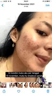 Tiens Spirulina Mask Masker Muka Skincare Spirulina Spakare UBAT JERAGAT PARUT PUTIHKAN