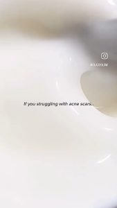 Glad2Glow Yuja Symwhite 377 Dark Spot Moisturizer 30ml Whitening Night Cream Fade Dark Spots Brighten Skin Improve Uneven Skin Tone