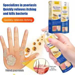 Psoriasis care spray Skin care spray Delicate skin Useful for the whole body Gentle skin care spray⚡