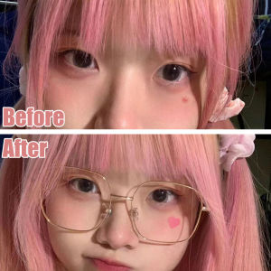 New Star Pimple Patch Stickers Dazzling Colorful Face Care Acne Removal Concealer Face Spot Skin Care Sticker Beauty Tool