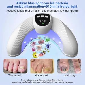 Nail Fungus Laser Treatment Device Effective Onychomycosis Therapy Machine Repair Toenail Fingernail Fungus Remover