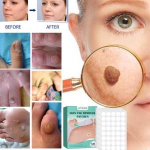 120PCS JAYSUING SKIN TAG PATCHES Penanggal ketuat kutil tahi lalat bintik hitam corn remover mole remover