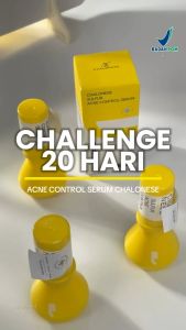 CHALONESE Krim jerawat 30g/Krim Bintik Pemutih/Obat Jerawat Ampuh/salep pembersih wajah/Penghilang Flek Hitam Membandel Di Wajah Paling Ampuh Permanen Bisa Untuk Wanita dan Priakrim penghilang jerawat dan bekas jerawat(Acne Removal Cream)