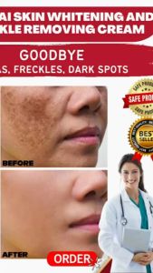 Ready Stock Krim jeragat Whitening Freckle Remover Cream Pigmentation Remover Cream Dark Spot Black Spot Remove20g美白祛斑霜