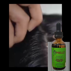 59mL Rosemary Essential Oil for Hair Growth Anti Hair Loss Serum Scalp Repair Scalp Frizzy Thinning Damaged Hair Strengthening Oil