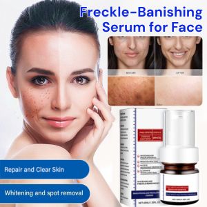 Freckle-Banishing Serum for Face Repair and Cleanse Dark Spots Anti Acne Essence Anti-Aging Reduce Fine Lines Moisturizing Brightening