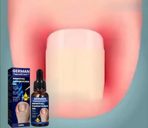 Tinh chất thẩm thấu kim phẩn tử làm mềm kết cấu móng và phục hồi sức khỏe. 10ml