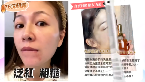 【Ready Stock】TRUU 76 Yeast Amino Acid Purifying Cleanser 150ml – Probiotic Face Wash for Sensitive Dry Skin truu童#76酵母胺基酸净肤洁颜露