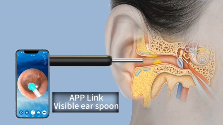【SKIT SG】Ear Wax Removal Cleaner Intelligent Visible Ear Spoon with Camera 1296P HD Video Otoscope Earwax Cleaning Wireless Endoscope Earpick for Kids Adults, Earwax Removal Cleaner Visual Ear Cleaner with 3.5mm Camera 6 LED Light 1296P FHD Video Otoscope