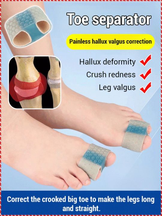 Orthosis Sa Paa Men's and Women's Bigfoot Double Toe Orthotics Fiber ...