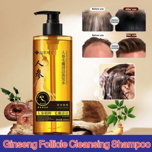Ginseng Follicle Cleansing Shampoo Anti-Hair Loss Shampoo Hair Growth Shampoo Remove Dandruff Relieve Itching Scalp Care
