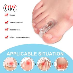 CCW 1 Pair Big Toe Separator Toe Orthosis Clip Pads Hallux Valgus Bunion Corrector Overlap Separators