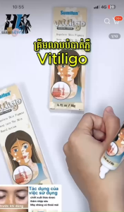 Kem Hỗ Trợ Lang Ben Sumifun Thảo Dược - An Toàn Cho Da Kháng Viêm & Giúp Phục Hồi Sắc Tố Da Hiệu Quả Sau Thời Gian Ngắn