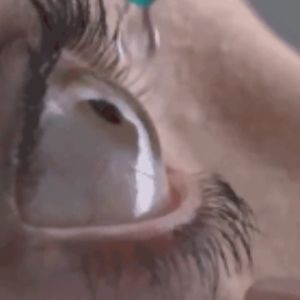 eye drop eye nursing bright light ubat sakit mata Improve Vision Alleviate Fatigue Resis Myopia itchy eye Eyedrop Visual Fatigue Relieve and Protect Eyesight