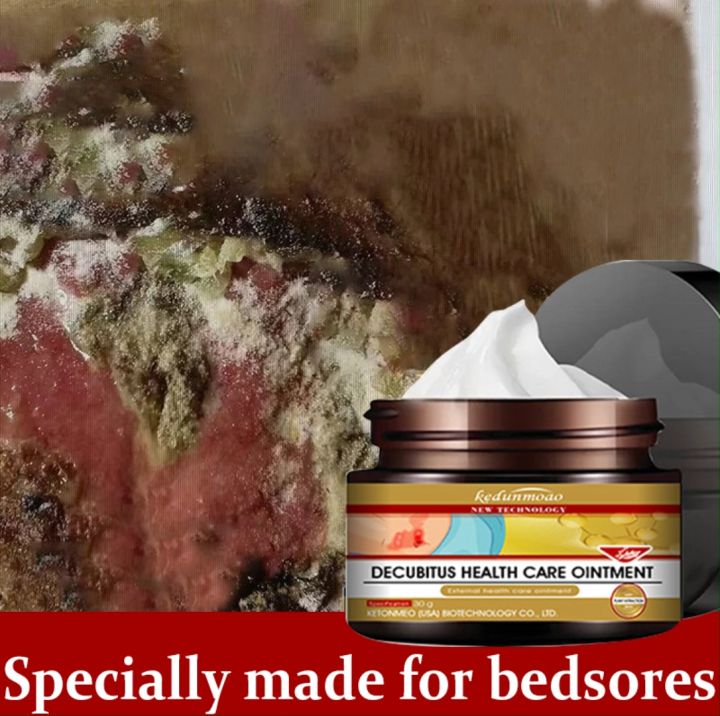 Sores Rotten Bedsores Cream Wound Healing Cream Herbal Bedsores Cream For Bed Sore ...
