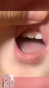 Childrens Oral Anti-Cavity Probiotic Cleaning Spray white tooth spray Healthy Moth-Proof Baby Teeth Protection Probiotics spray 40ml