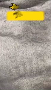 Miếng Dán Mụn Cóc Corn Removal Plaster 6 Miếng/Hộp | Miếng Dán Chai Chân Salicylic Acid Hỗ Trợ Chăm Sóc Da Chai Sừng Dùng Tiện Lợi Mỗi Ngày
