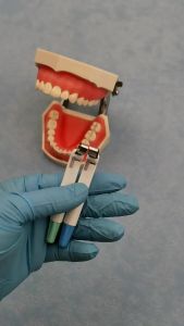 GULPOOE Dental Matrix Band Adjustable Anterior Posterior Matrix System Lab For Dental Crown Materials Steel Standard Disposable