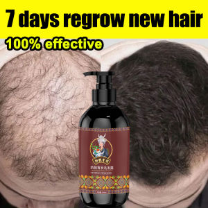 Hair Growth Shampoo Anti Hair Loss Shampoo 500ml Hair Fall Shampoo For Weakened Hair Thinning Hair Herbal Stabilises Hair Roots Promotes Hair Growth Increases Hair Volume