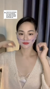 Mặt nạ nâng cơ mặt giảm nếp nhăn nâng cơ chống chảy xệ và định hình cằm V-Line