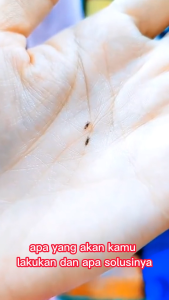 CLANISH Shampoo Penghilang Kutu Rambut | Atasi Ketombe & Gatal Cepat