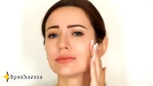 Obat Jerawat - Acnol Lotion For Acne 10ml