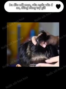 Dầu Gội Sạch Gàu Dầu Gội Gội Loại Bỏ Mạt Dầu Gội Giảm Ngứa 300ml