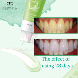 LYDIMOON Probiotics whitening toothpaste 120g Teeth whitening pemutih gigi kuning total whitening antibacterial toothpaste tartar remover fresh breath