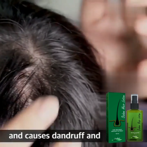 OUHOE Dense Hair Spray Nourishing Damaged Dry Repair Scalp Strengthen Hair Growth Serum Repair Damaged Hair Dense Hair 120ml
