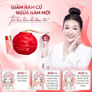 FACE HUYẾT NÁM BÓC TÁCH X2 Da cải thiện mờ nám tàn nhang sau 1 liệu trình sử dụng.