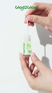 Glad2Glow Acne Drying Lotion - Mengeringkan Jerawat 8 Jam - Totol Jerawat - Virgo Shoop