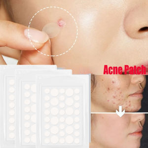 Sunfeel สมบูรณ์แบบ สติกเกอร์ติดที่กดสิว24/36ชิ้นเครื่องมือการดูแลผิวแผ่นแปะสิวที่มองไม่เห็นสิว