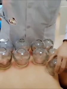 12PCS BODY CUPPING SET | Cupping Supplies | Ventosa Glass Ventosa Set | For Cupping Therapy | Durable Glass Construction | Complete Set | Easy to Use | Effective Therapy | Lightweight | Best Seller