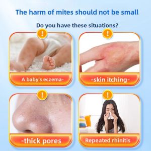 MONLEYTA | Authentic Japanese Dust Mite Spray Bedding Household No Rinse Kill Dust Mites Remove Eggs Prevent Allergy Normal Size Bedroom Use