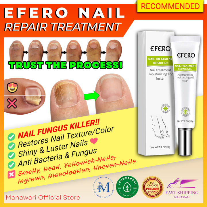 EFERO Nail Treatment Fungal Nail Fungus Treatment Cream Anti Fungal Nail Repair Gel Anti Fungus